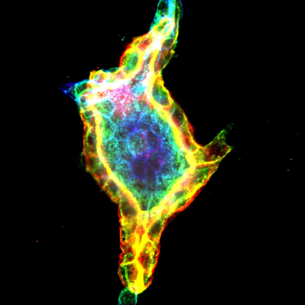 Fluorescence microscopy image of a group of cells