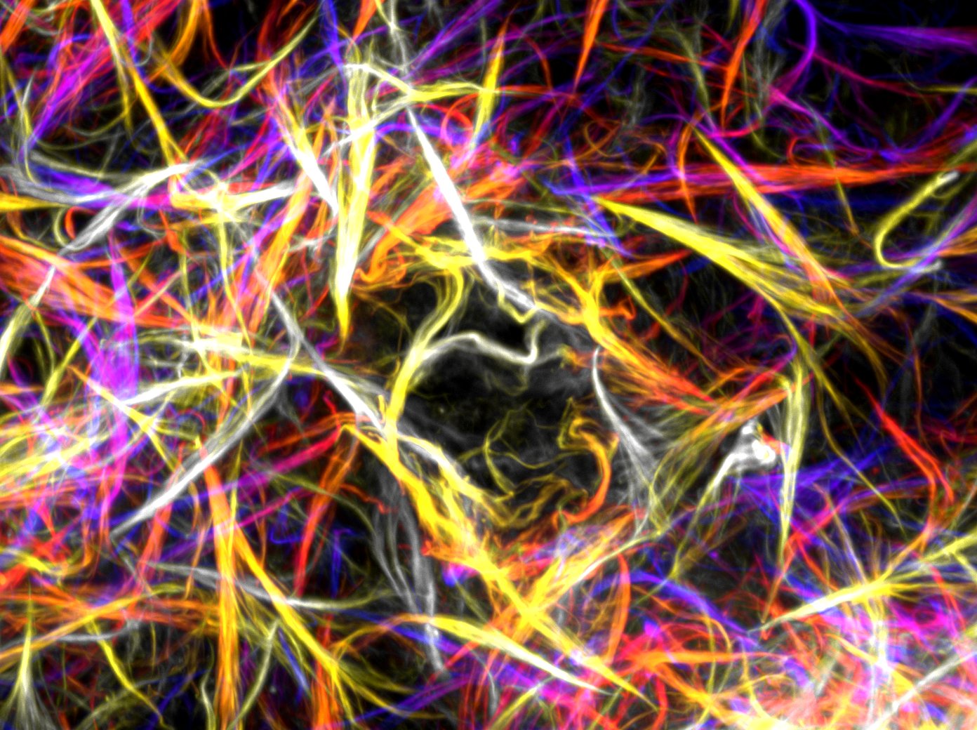 Fluorescence microscopy image of collagen fibrils