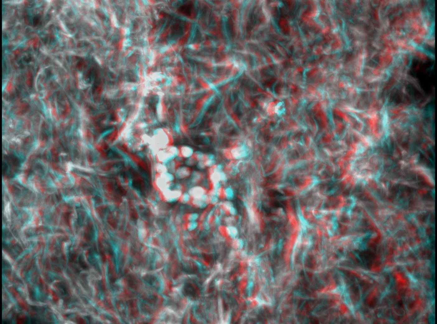 Fluorescence microscopy image of cells in a collagen gel
